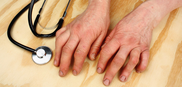 treatment of rheumatoid arthritis hand pain