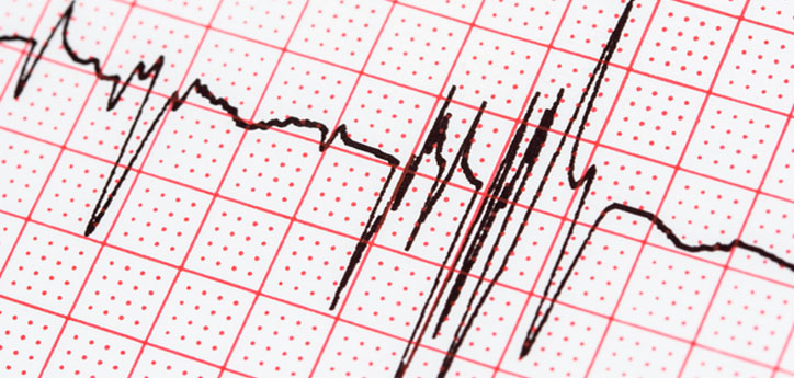 afib treatments, afib stroke treatment, afib medications, afib