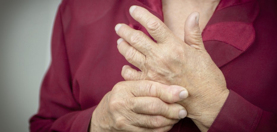 rheumatoid arthritis treatment