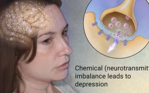 Is Your Birth Control Affecting Your Overall Mental Health?, What’s The Difference Between Bipolar I And Bipolar II?, 10 Signs: Recognizing the Symptoms of Bipolar Disorder, bipolar depression treatments, bipolar disorder treatment, severe depression, Helping Loved Ones With Depression, 5 Surprising Signs Of Depression, Can Psychedelic Drugs Benefit Depression And Anxiety?, Depression, Depression And New Dads: Are You At Risk?, How To Treat Depression: Advanced Methods, Postpartum Depression Explained, treat depression, help with depression