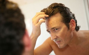 Get the Ultimate Hair Loss Treatment for Your Hair, hair loss, hair loss prevention