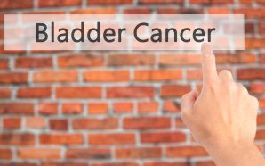 C Treatment for Bladder Cancer