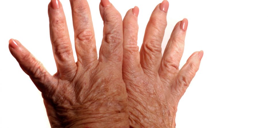 rheumatoid arthritis fibromyalgia treatments