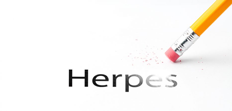 cure herpes